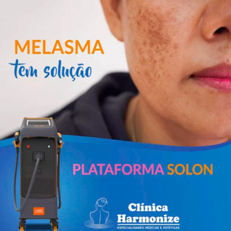 Melasma como tratar